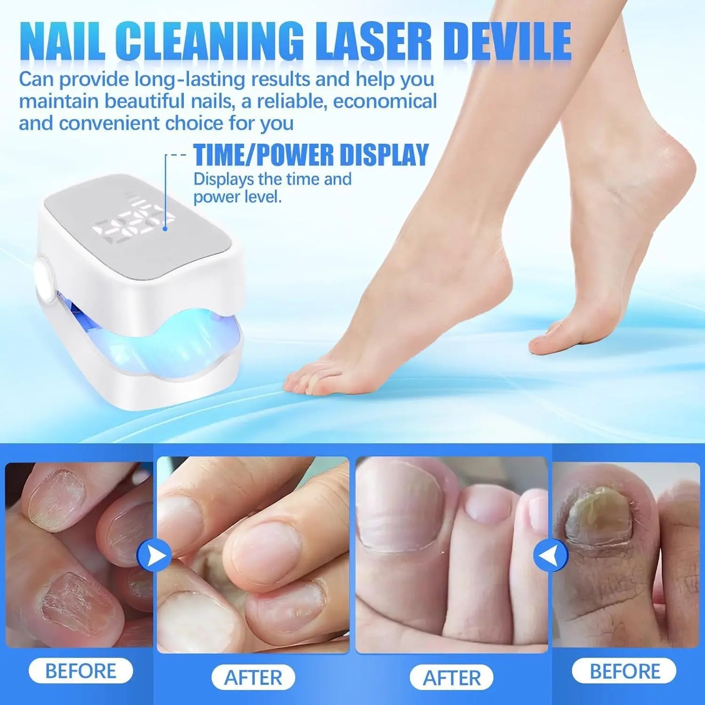 OnyxNail™ – Say goodbye to fungal infections in 30 days | Money-back guarantee