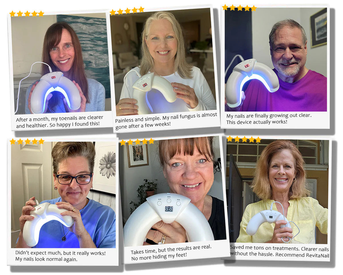 RevitaNail Pro™- Eliminate nail fungus in 30 days | Money-back guarantee